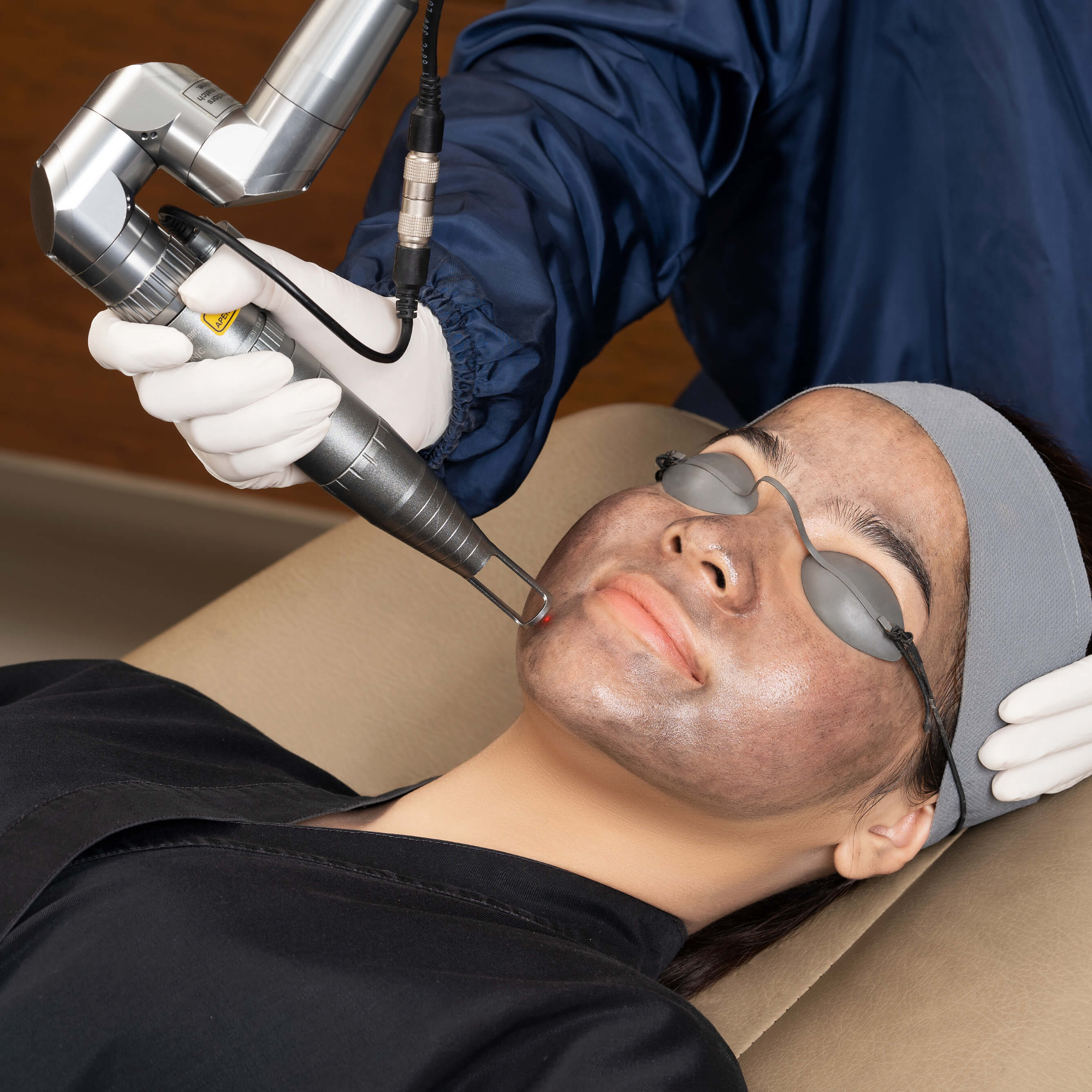 Article Treatment Wajah Berjerawat yang Aman untuk Kulit Sensitif dan Meradang