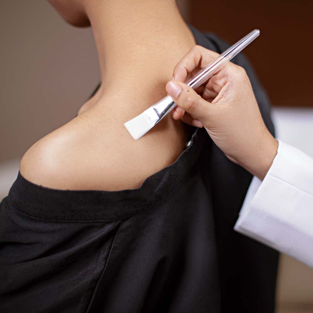 Image Derma Peeling for Chest