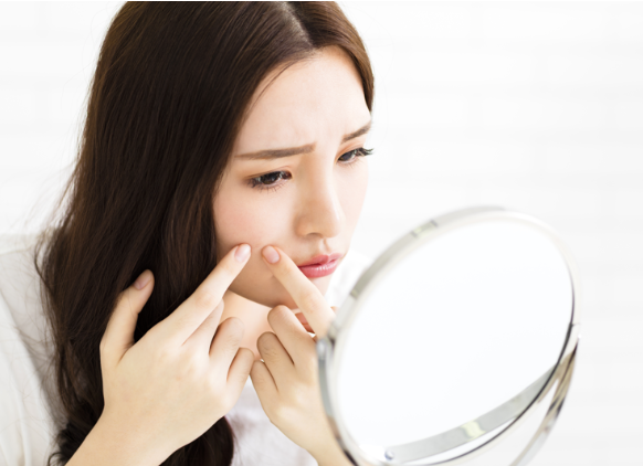 Article Kulit Bebas Jerawat Dengan Treatment Acne Peeling Face Di Erha Ultimate!