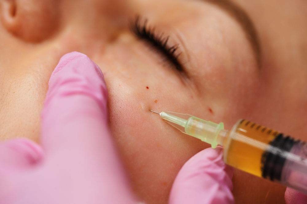 Article Kembalikan Vitalitas Kulit Dengan Mengenali Macam-Macam Treatment Rejuran di ERHA Ultimate