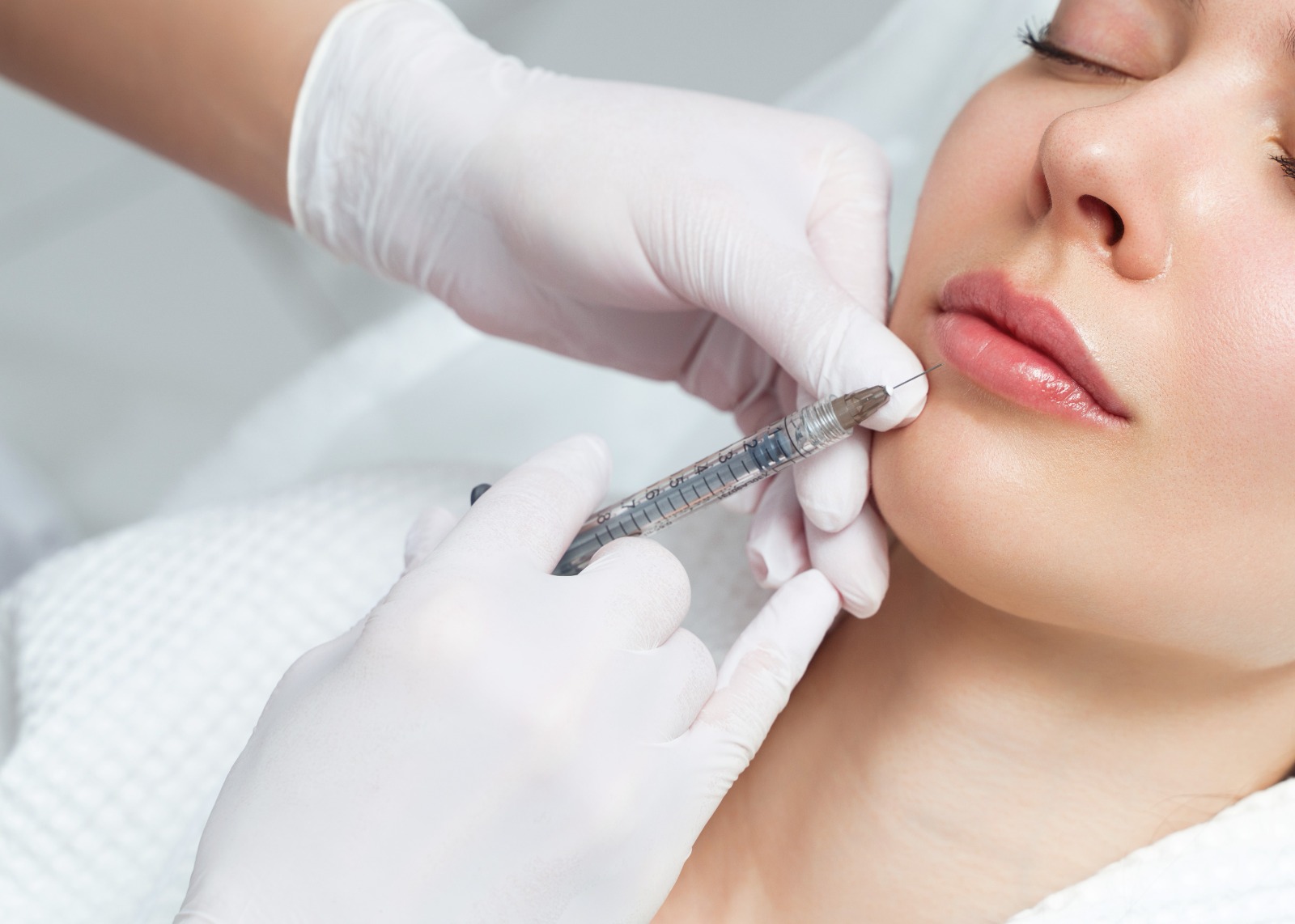 Article Fakta Lip Filler, Tidak Perlu Takut Jika Mau Coba Pertama Kali