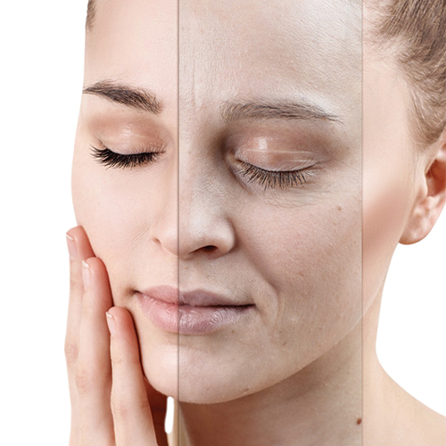 Article Kulit Sehat Muda Terlahir Kembali Dengan Ultimate Skin Reborn By Profhilo