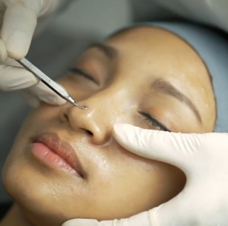 Article Hydra Glow Facial Treatment Kecantikan Yang Membuat Wajah Glowing