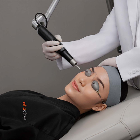 Article Apakah Treatment Laser Efektif Untuk Menghilangkan Dark Spot?
