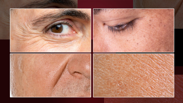 Article Tanda-Tanda Penuaan Yang Kerap Muncul Pada Pria