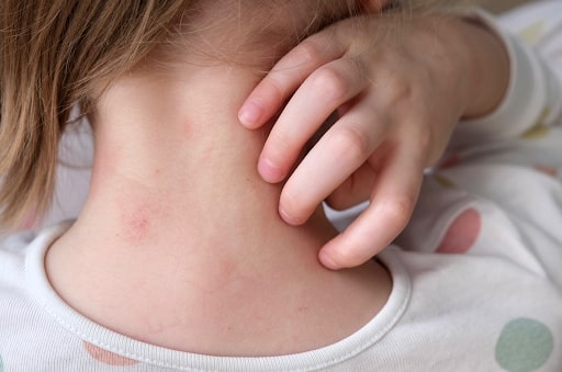 Article Atopy and Skin Disease Center, Ahli Perawatan Kulit Tepat dari ERHA Ultimate