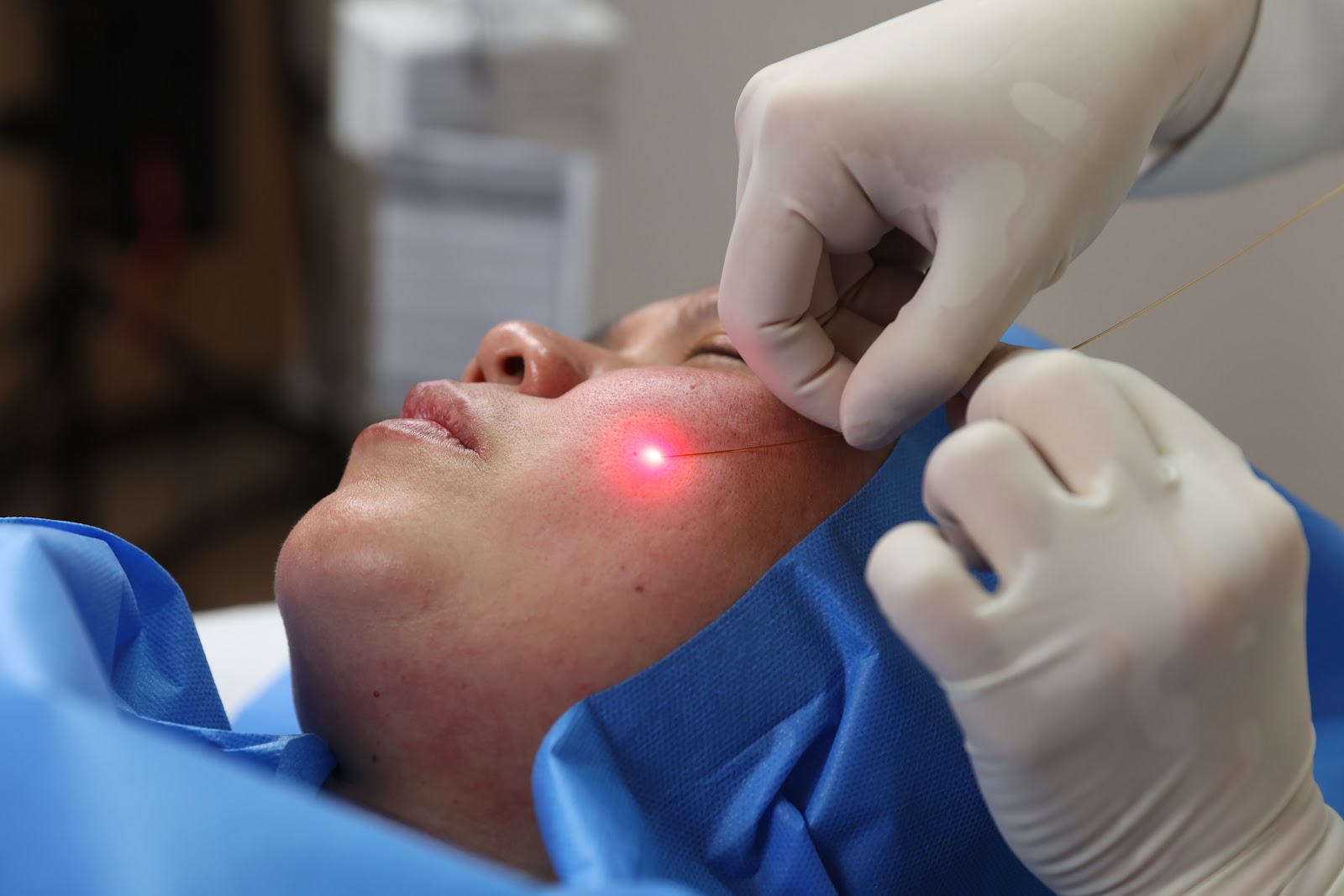 Article Kenali Endolift: Perawatan Wajah dan Tubuh yang Membuat Lebih Kencang dan Awet Muda