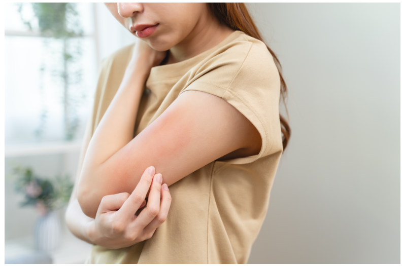 Article Waspada, Ini 5 Masalah Kulit Akibat Perubahan Cuaca