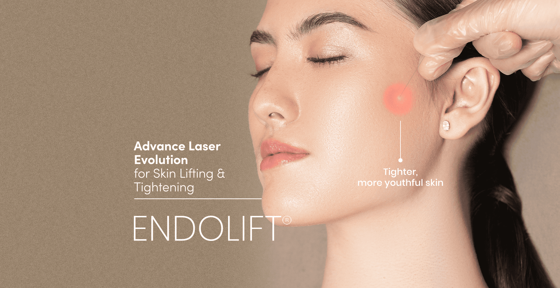 endolift banner