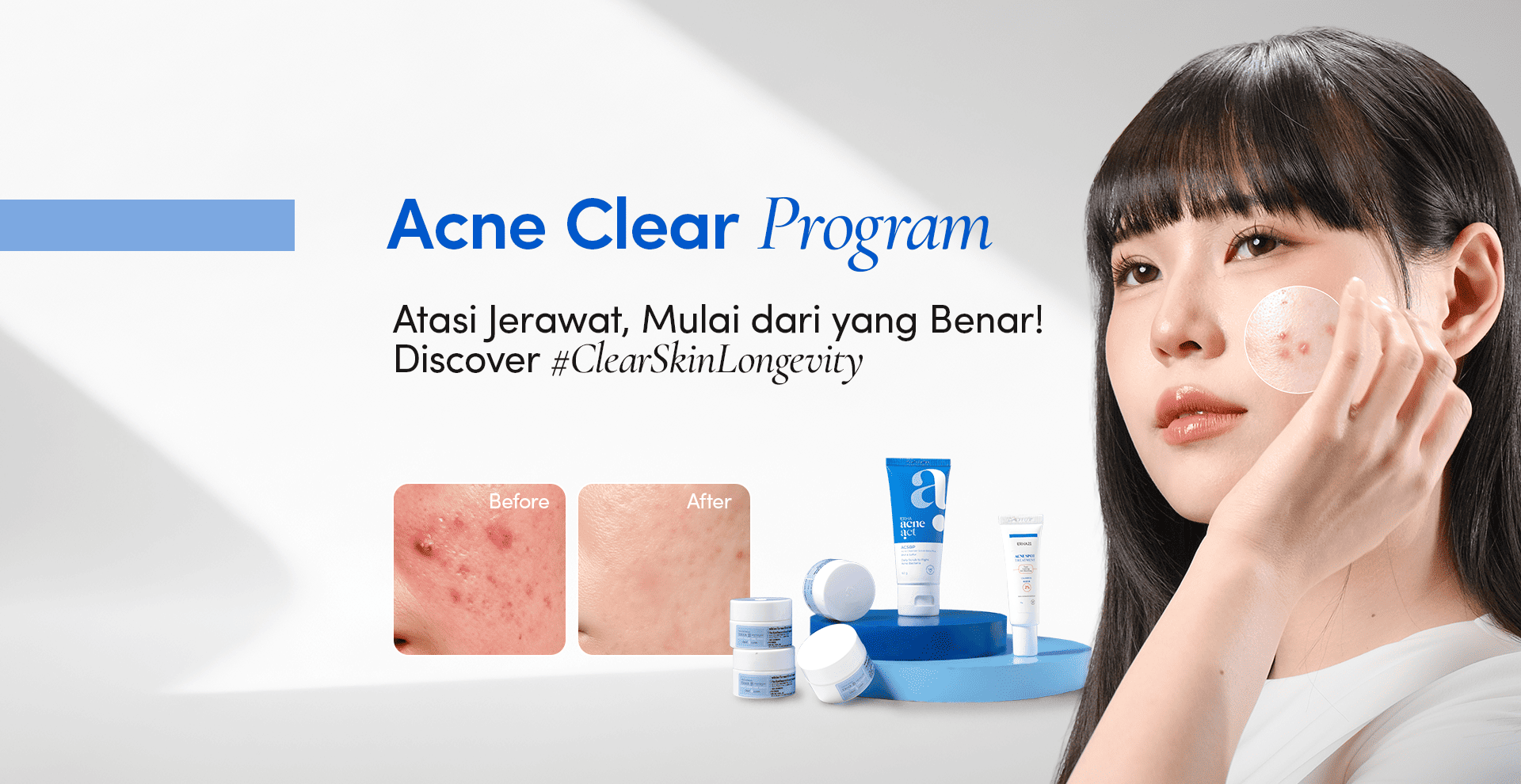 AcneClear
