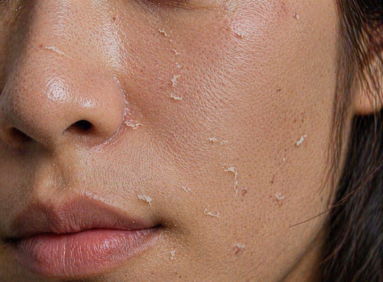 Article Kulit Berminyak Tapi Tetap Ketarik? Ini Penyebab Kulit Dehidrasi yang Sering Diabaikan