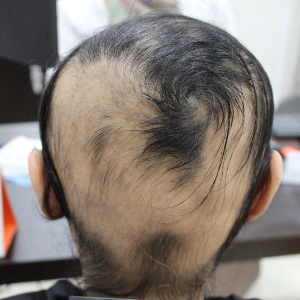Before