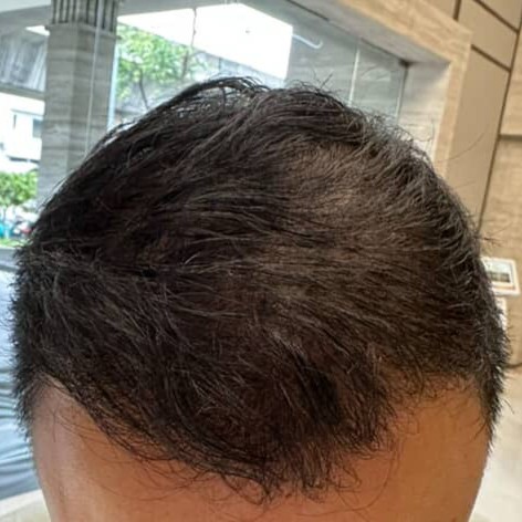 After