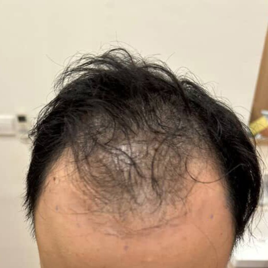Before