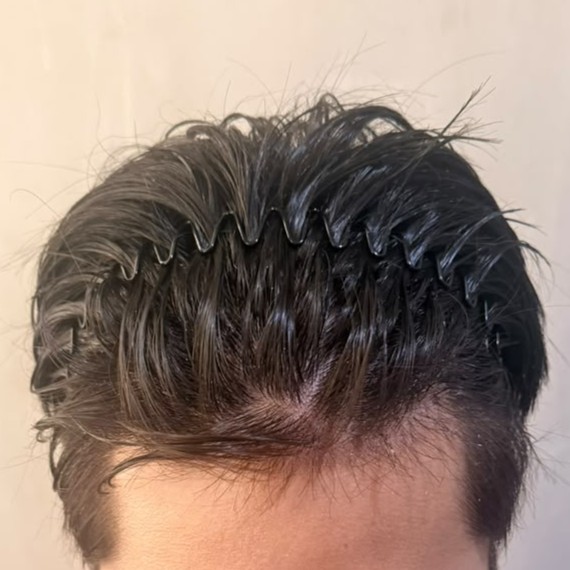 After