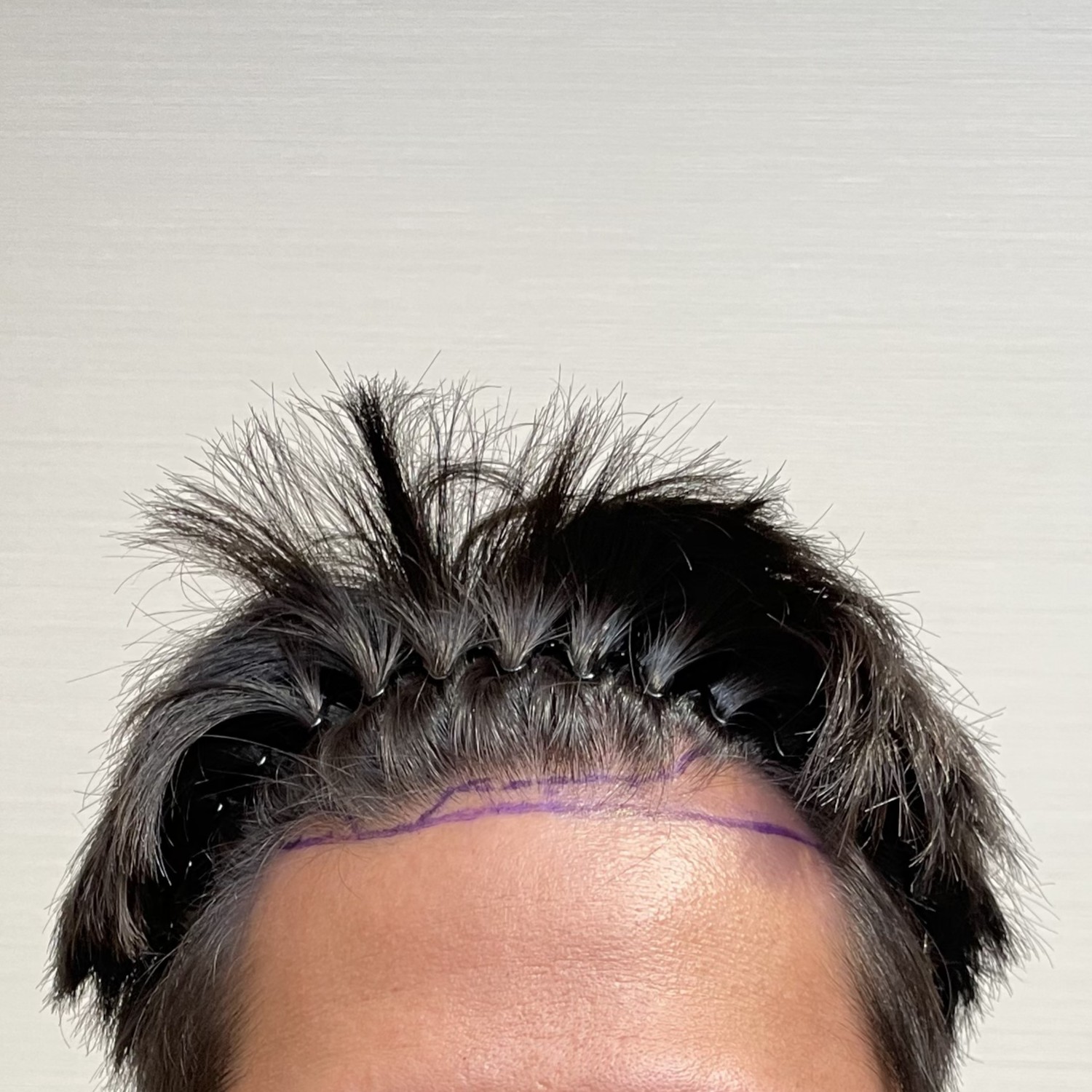 Before