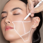 THREADLIFT