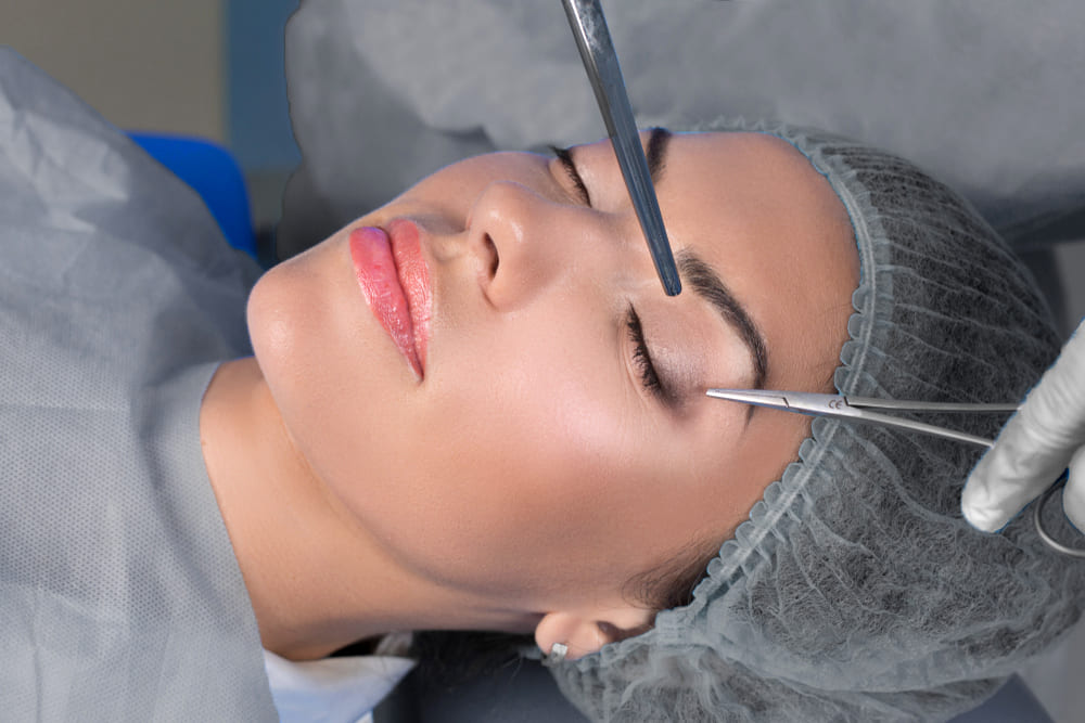 Article Ingin Punya Double Eyelid? Lakukan Prosedur Blepharoplasty di ERHA Ultimate