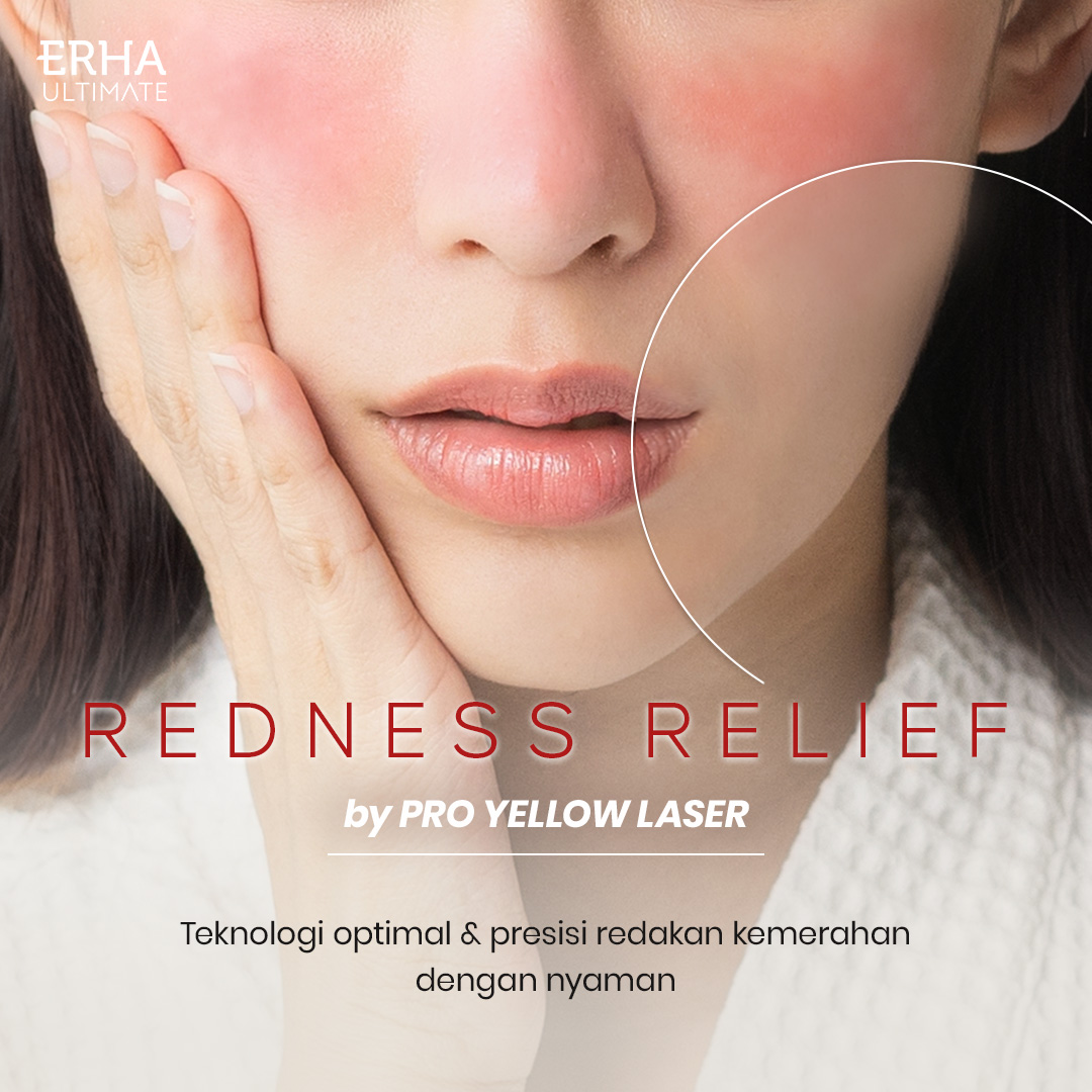 Article Bebas Bekas Jerawat Kemerahan dengan  Pro Yellow Laser dari ERHA Ultimate