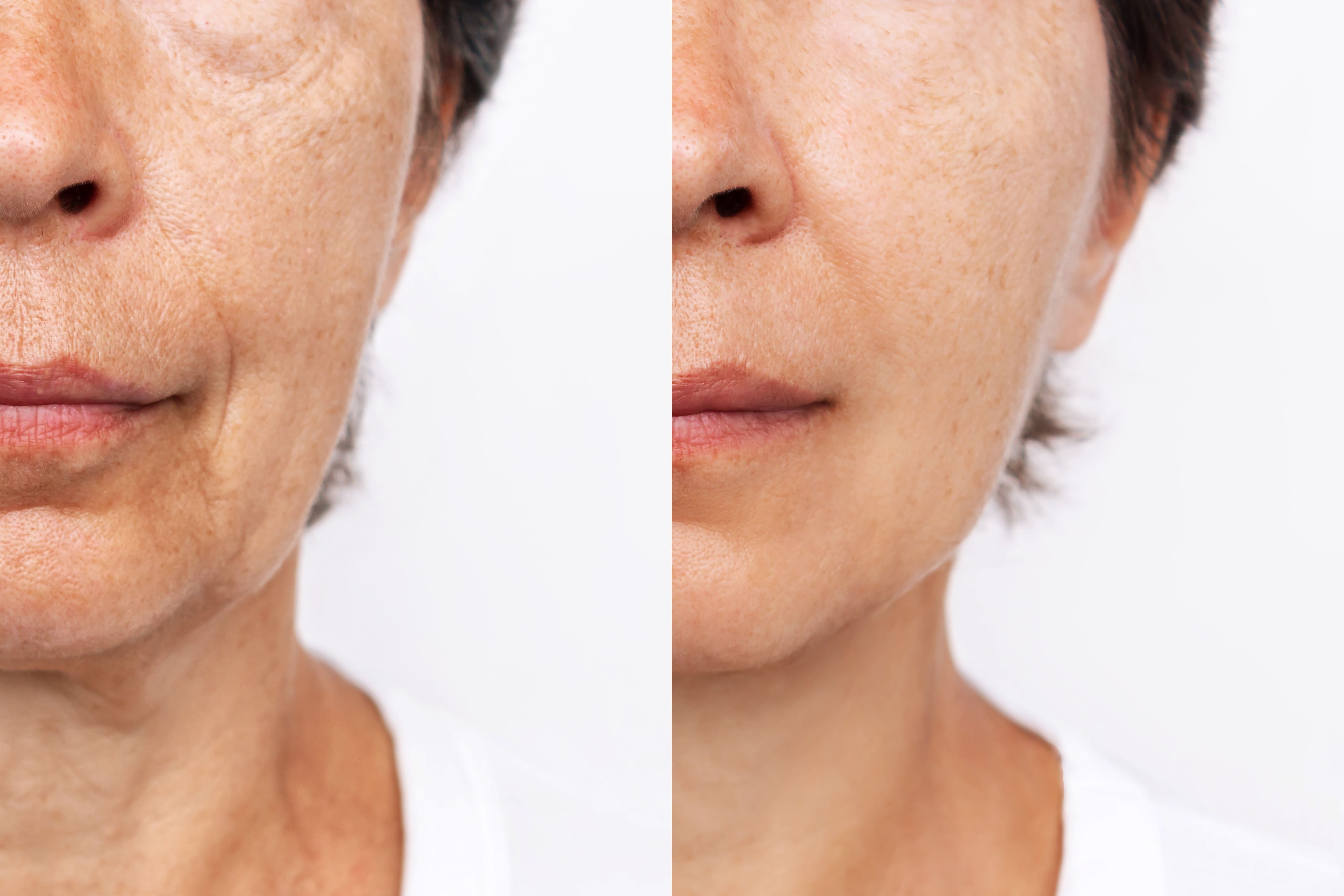 Article Investasi Kulit Masa Depan: Perawatan Anti-Aging dengan Active Growth Factor dari ERHA Ultimate