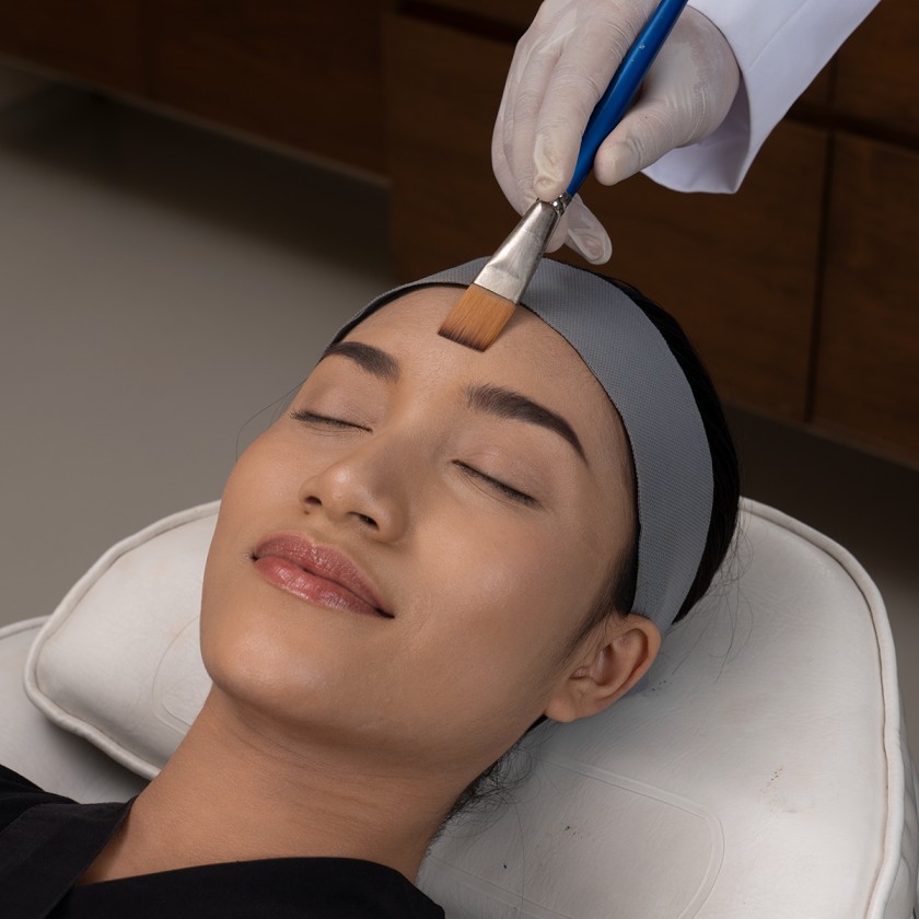 Image Acne Peeling for Full Face