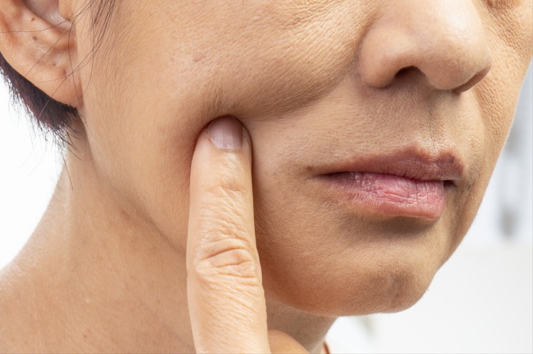 Article Kulit Wajah Mulai Kendur dan Pori-Pori Besar? Ultimate Skin Reborn by Profhilo Solusinya!