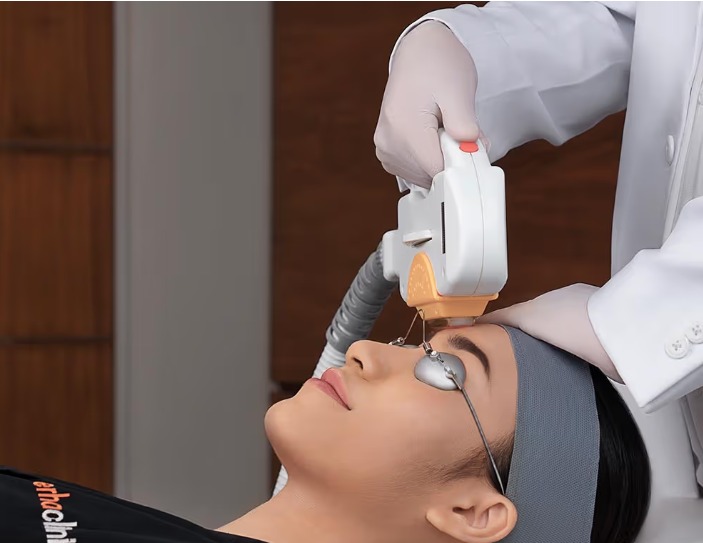 Image Post Acne Redness Fade Away by IPL